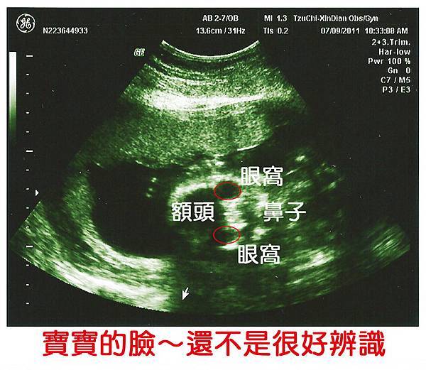 2011年7月9日鈺銘在媽咪肚子裡約141天-超音波照片-臉部