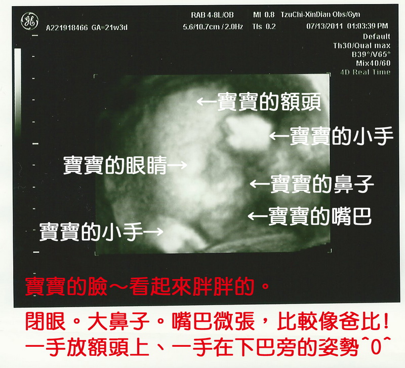 2011年7月13日鈺銘在媽咪肚子裡約145天-3D超音波照片