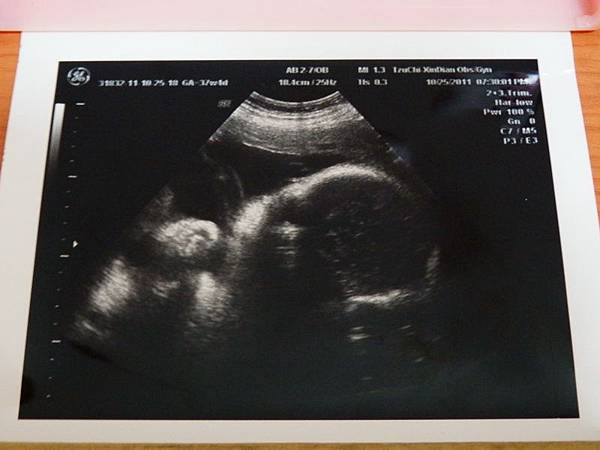 2011年10月25日鈺銘在媽咪肚子裡約249天
