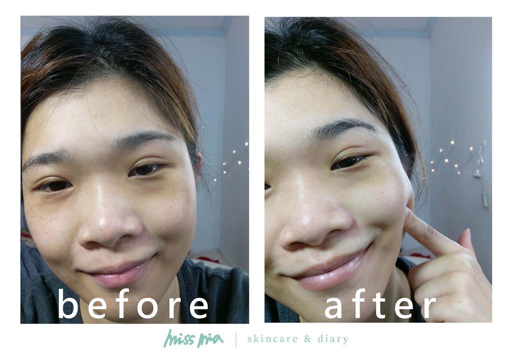 03-before-after.jpg