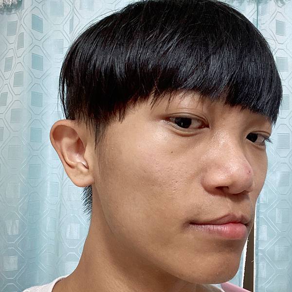 3-4天脫皮2.jpg 3-4天脫皮2.jpg