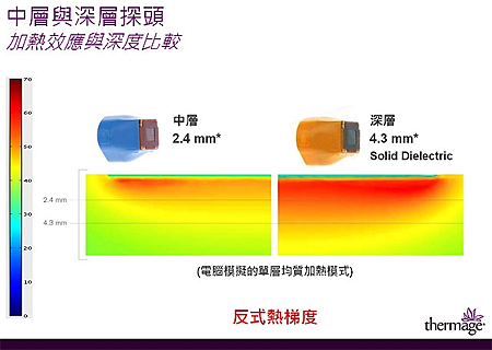 陳總院長【Thermage DC Tip3.0塑顏電波】施打經驗與治療原理分析