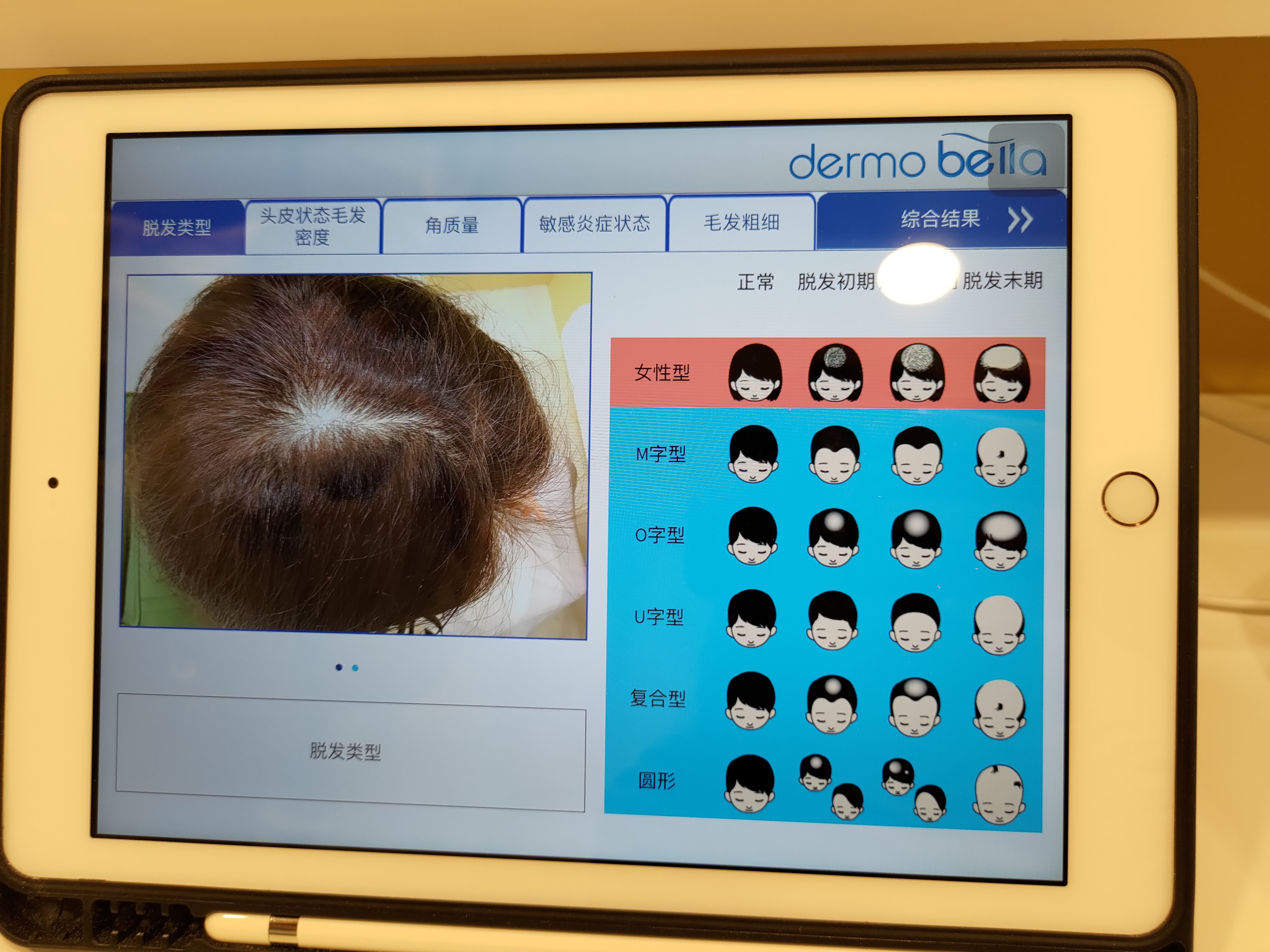 P_20221110_165602.jpg 試用