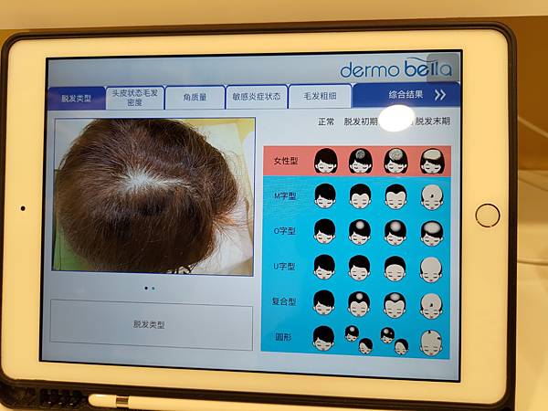 GaGa量身訂做診間科學專業頭皮檢測｜找到頭皮真正問題｜水狀洗髮精｜頭皮檢測ptt｜天界之舟行善濟世06