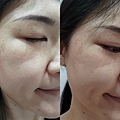 保養開箱｜船井生醫《醫朵Ido黑玫瑰抗老修護系列》黑玫瑰重生緊膚金萃、黑玫瑰抗老膠原乳霜｜媽媽界撫紋神器｜熬夜必備 (14).jpg
