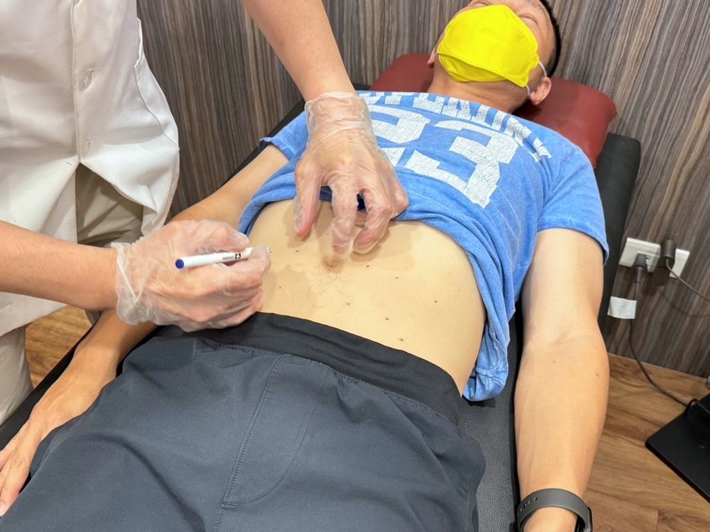 台南減重推薦｜半年狠甩15公斤｜健恩中醫減肥門診｜埋線減肥推