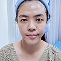 WIQOUNO液態水光肌21.jpg