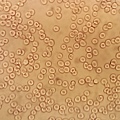 blood cells (normal)