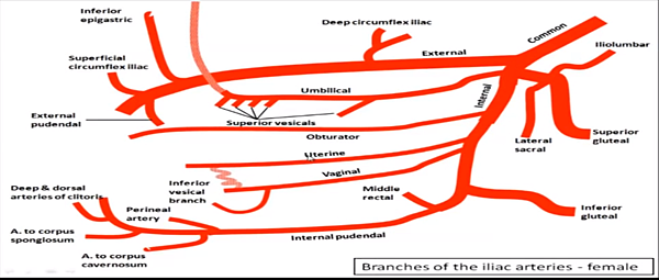 iliac artery female