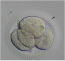 embryo02