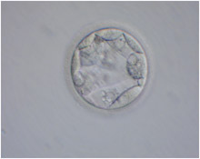 blastocyst01