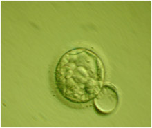 blastocyst02