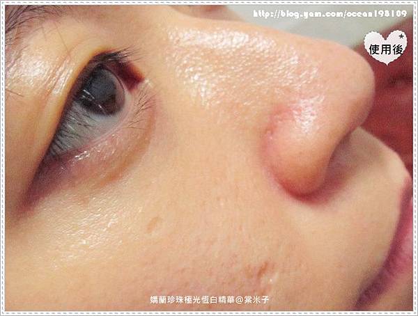 使用後(臉) 使用後(臉)