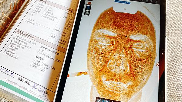 台北打雷射推薦|RedTouch PRO凍態雷射分享│台北東區醫美診所,羅峙錕醫師率領,僅接受預約制的綻妍診所-09.jpg