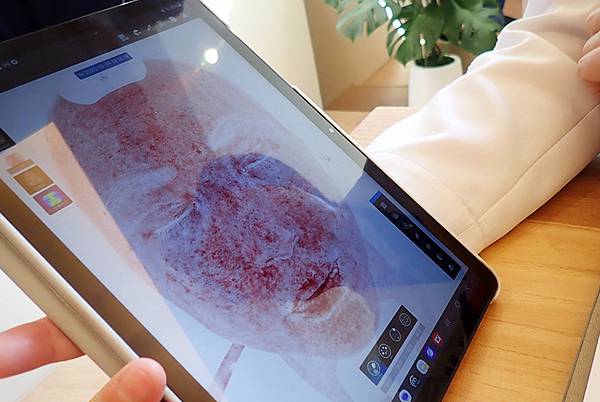 台北打雷射推薦｜RedTouch PRO凍態雷射分享│台北東區醫美診所，羅峙錕醫師率領，僅接受預約制的綻妍診所-14.jpg