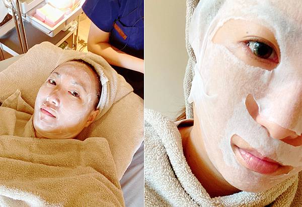 台北打雷射推薦|RedTouch PRO凍態雷射分享│台北東區醫美診所,羅峙錕醫師率領,僅接受預約制的綻妍診所-19.jpg