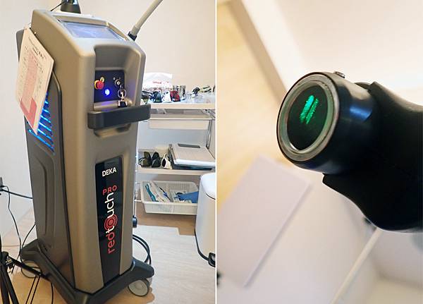 台北打雷射推薦｜RedTouch PRO凍態雷射分享│台北東區醫美診所，羅峙錕醫師率領，僅接受預約制的綻妍診所-26.jpg