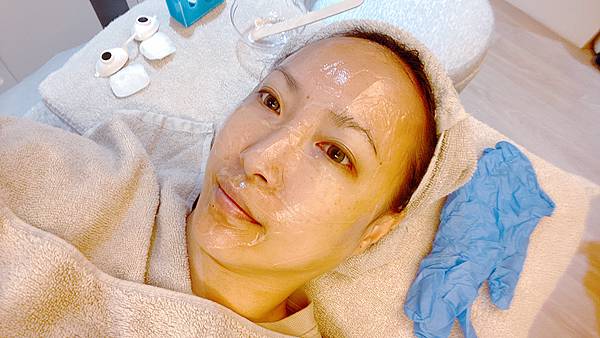 台北打雷射推薦|RedTouch PRO凍態雷射分享│台北東區醫美診所,羅峙錕醫師率領,僅接受預約制的綻妍診所-24.jpg