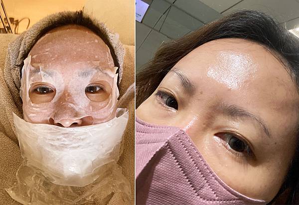 台北打雷射推薦|RedTouch PRO凍態雷射分享│台北東區醫美診所,羅峙錕醫師率領,僅接受預約制的綻妍診所-34.jpg