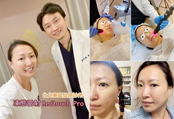 台北打雷射推薦｜RedTouch PRO凍態雷射分享│台北東區醫美診所，羅峙錕醫師率領，僅接受預約制的綻妍診所-00.jpg