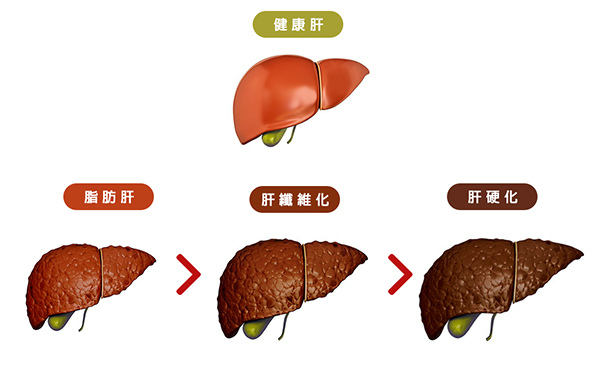 利九星 解酒 代謝酒精 酒精中毒 酒醉 解宿醉 千杯不醉 保肝 保健食品 護肝