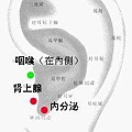 扁桃體炎.jpg