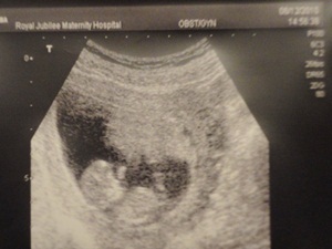 baby2-1.JPG baby2-1.JPG
