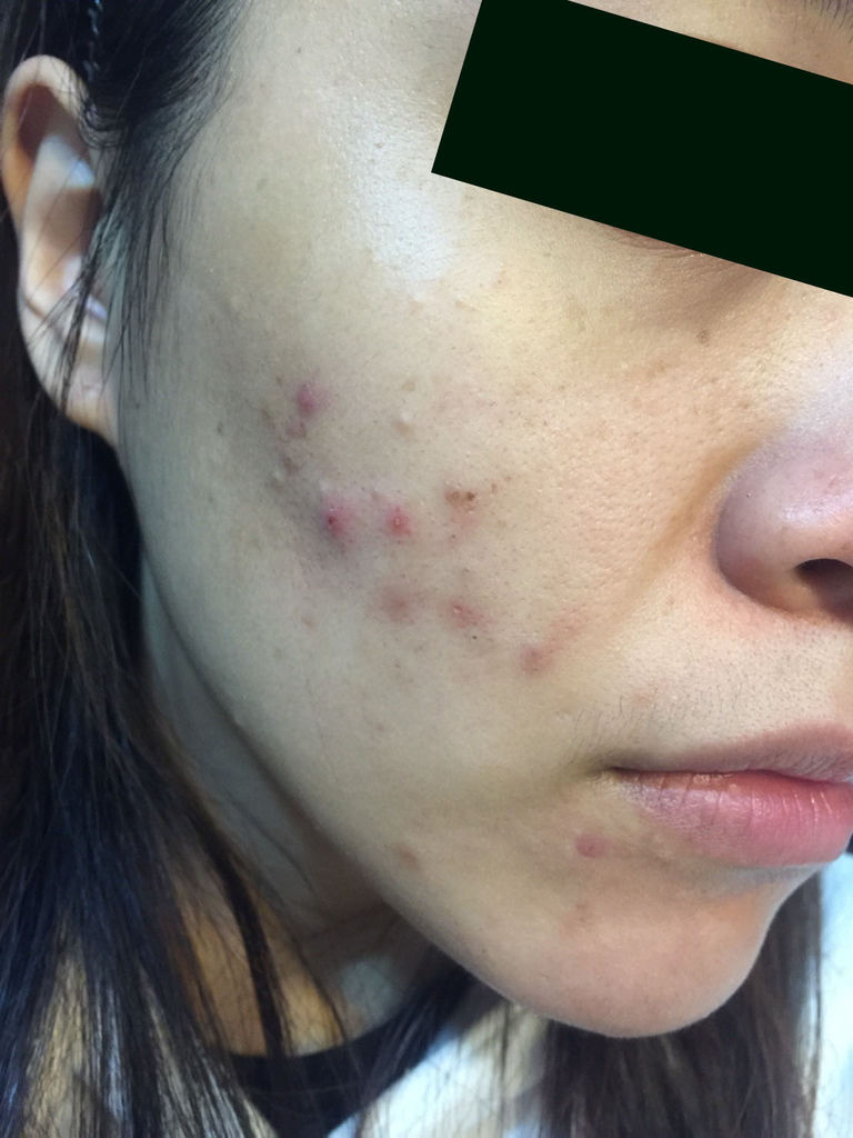 三月份觀察 (1).jpg 三月份觀察 (1).jpg