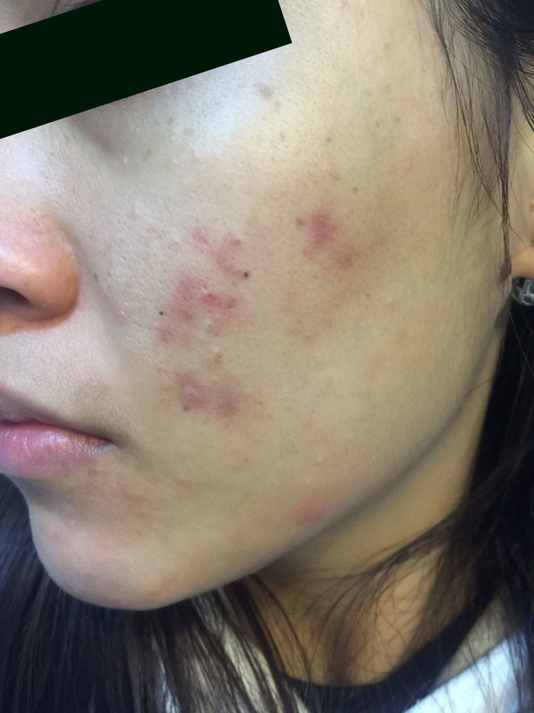 三月份觀察 (2).jpg 三月份觀察 (2).jpg