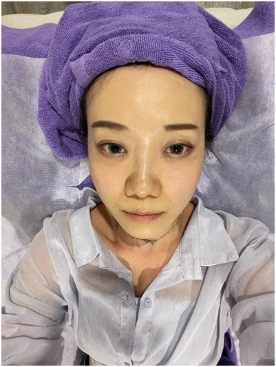 來愛爾麗醫美找回自信,龍捲風密集音波拉提讓我的臉部擺脫下垂 來愛爾麗醫美找回自信,龍捲風密集音波拉提讓我的臉部擺脫下垂