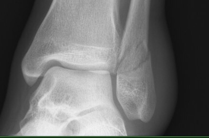 S__27738156.jpg S__27738156.jpg