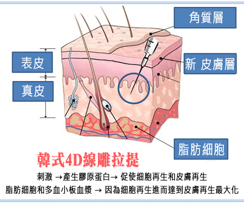 台中拉皮｜4D線雕提拉10