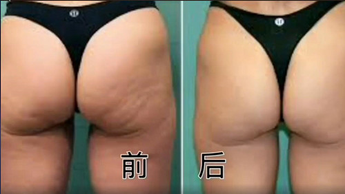 前後比較_副本 前後比較_副本