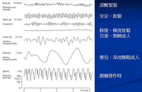 n-sleeplessness-40402.gif