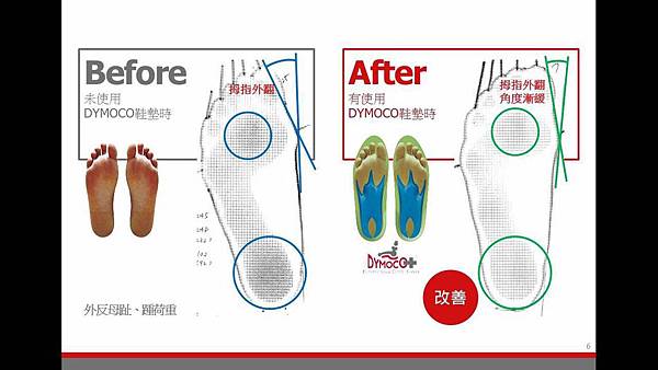 Dymoco介紹7.JPG