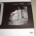 寶寶6個月大時4D的照片