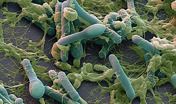 Clostridium-botulinum-sem