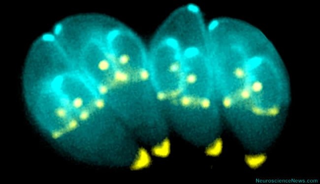 toxoplasma-gondii-suicide