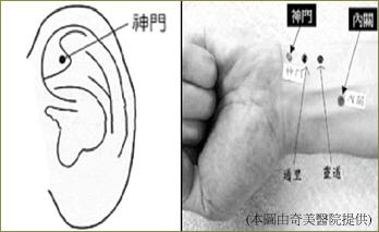 刮痧減肥法6