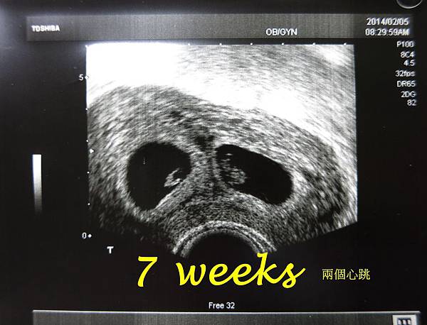 7weeks_1