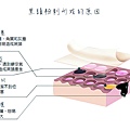 黑頭形成圖1.jpg