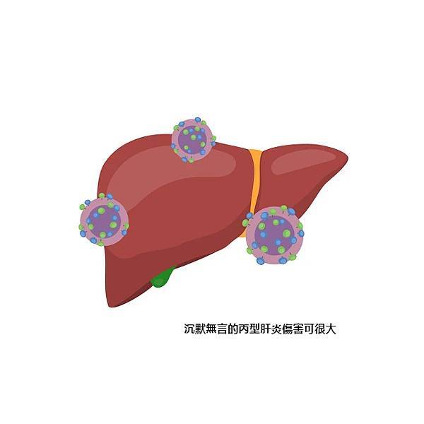 沉默無言的丙型肝炎傷害可很大