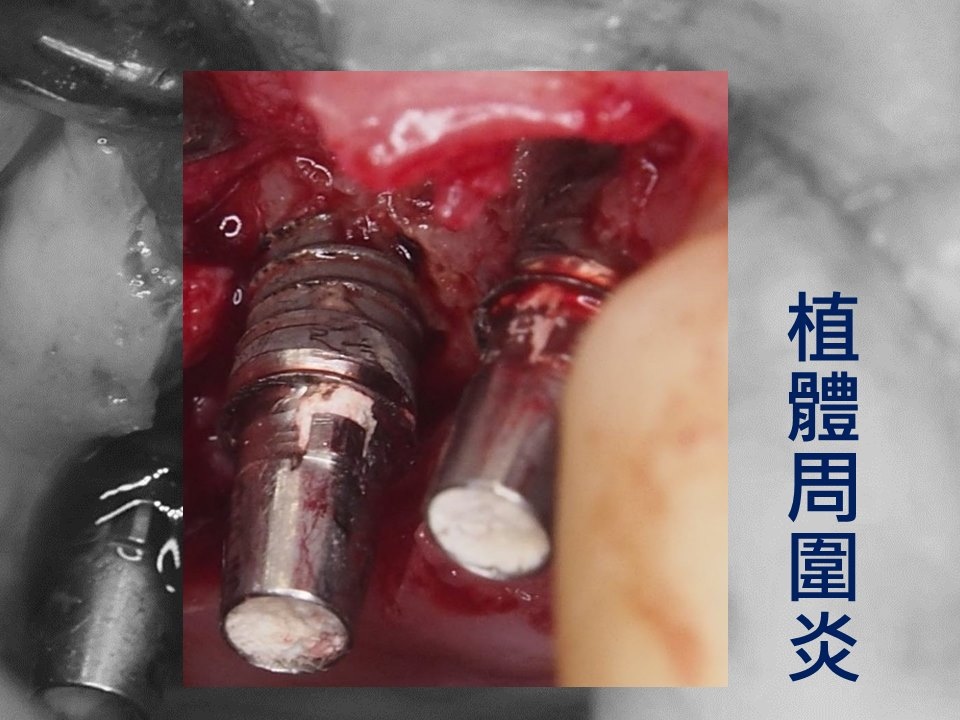 19029416_1876794699205575_5551456601441268344_n.jpg 19029416_1876794699205575_5551456601441268344_n.jpg