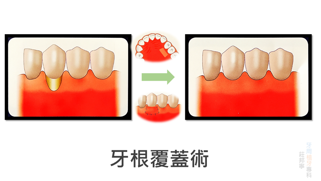 19957024_1890659837819061_5727153164118809711_o.png 19957024_1890659837819061_5727153164118809711_o.png