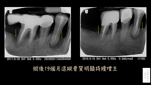 投影片11.PNG 投影片11.PNG