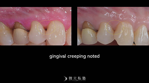 投影片6.PNG 投影片6.PNG