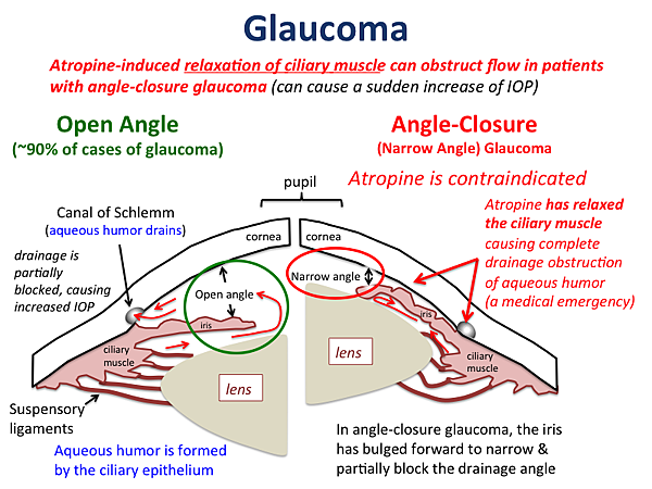 glaucoma.png