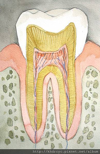 [根管治療] 為什麼我的牙齒不會痛牙醫師卻建議抽神經 高雄牙