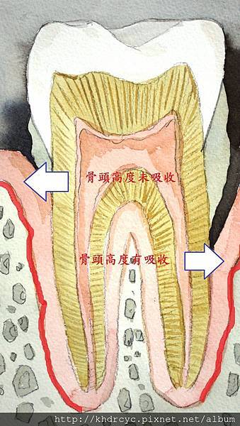 高雄牙醫/左營牙醫/牙醫推薦/高雄植牙 高雄牙醫/左營牙醫/牙醫推薦/高雄植牙