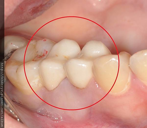 鑄心6.jpg 鑄心6.jpg